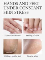 ⁦ماسك القدمين⁩ - الصورة ⁦4⁩